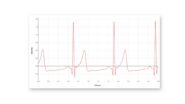 Go Direct® EKG Sensor 2